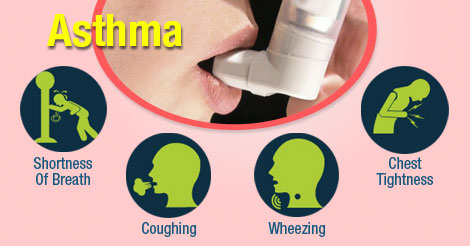 Asthma