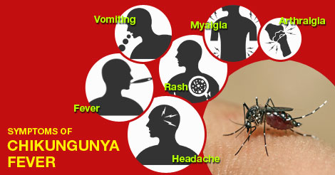 Signs & Symptoms of Chikungunya Fever