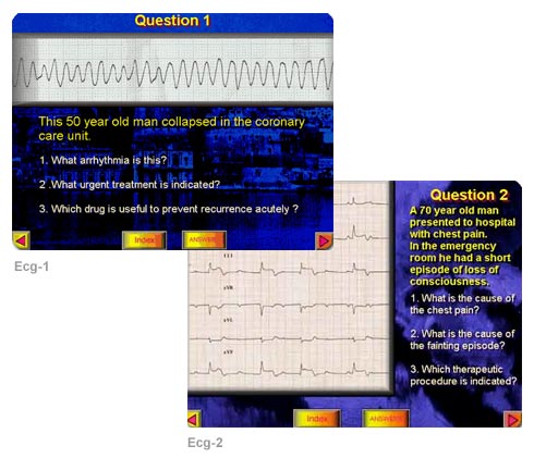 ECG Tutorial