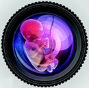 Should Doctors Click Foetuses to Save Girl Child?