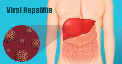 Viral Hepatitis