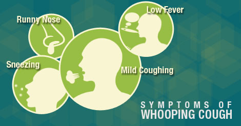 Signs & Symptoms of Whooping Cough