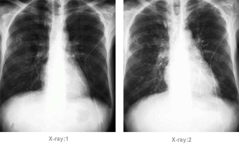 X-Ray