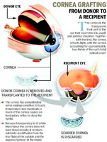 Eye Donations in Pune District Rise