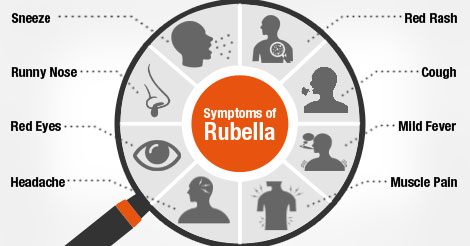 Prodromata The prodromal symptoms of rubella (coryza, sore... 