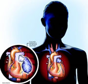 City Surgeon Corrects Rare Heart Condition City Surgeon Corrects Rare Heart Condition